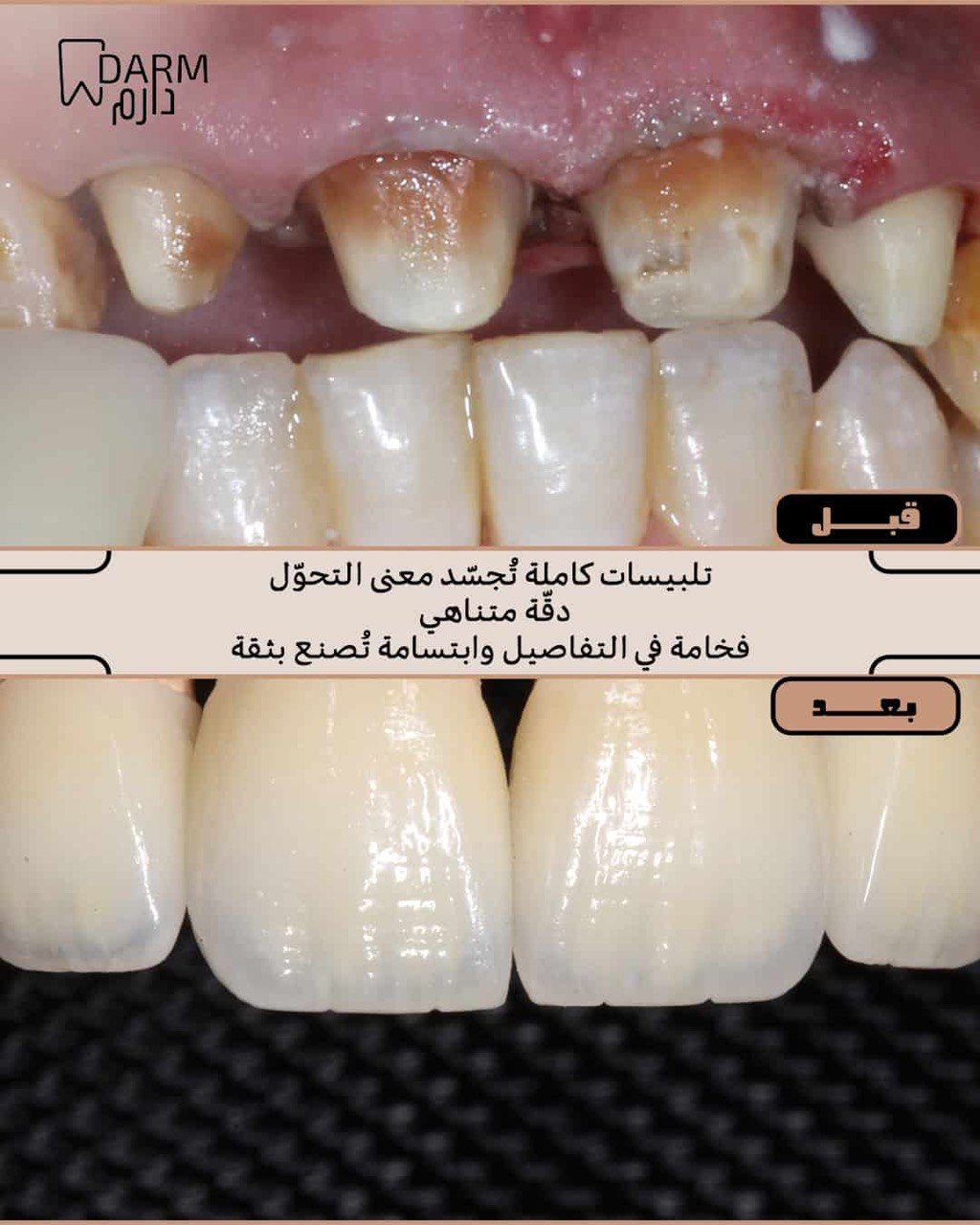 حالة 2