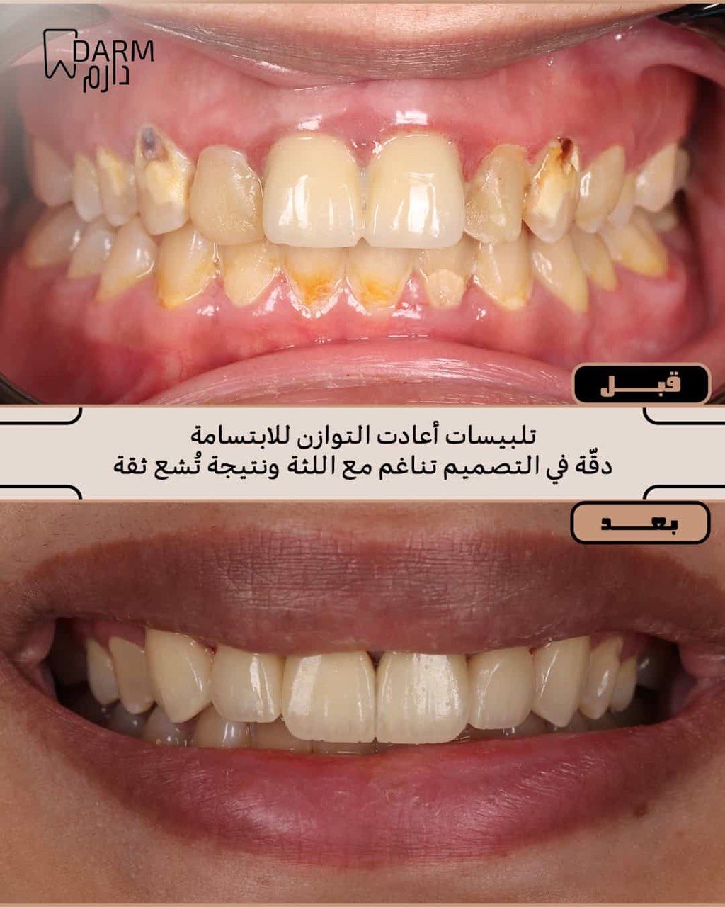 حالة 3