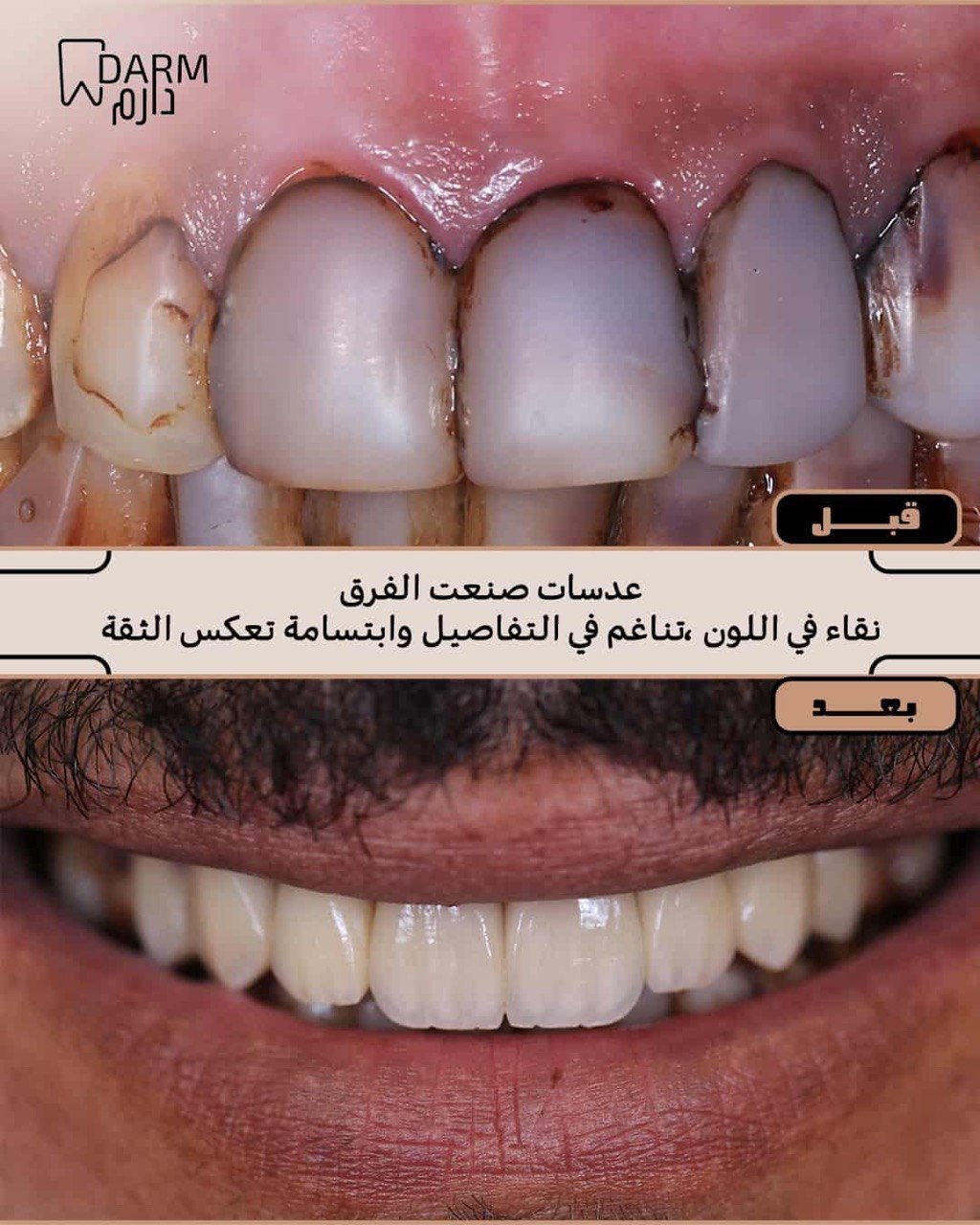حالة 5