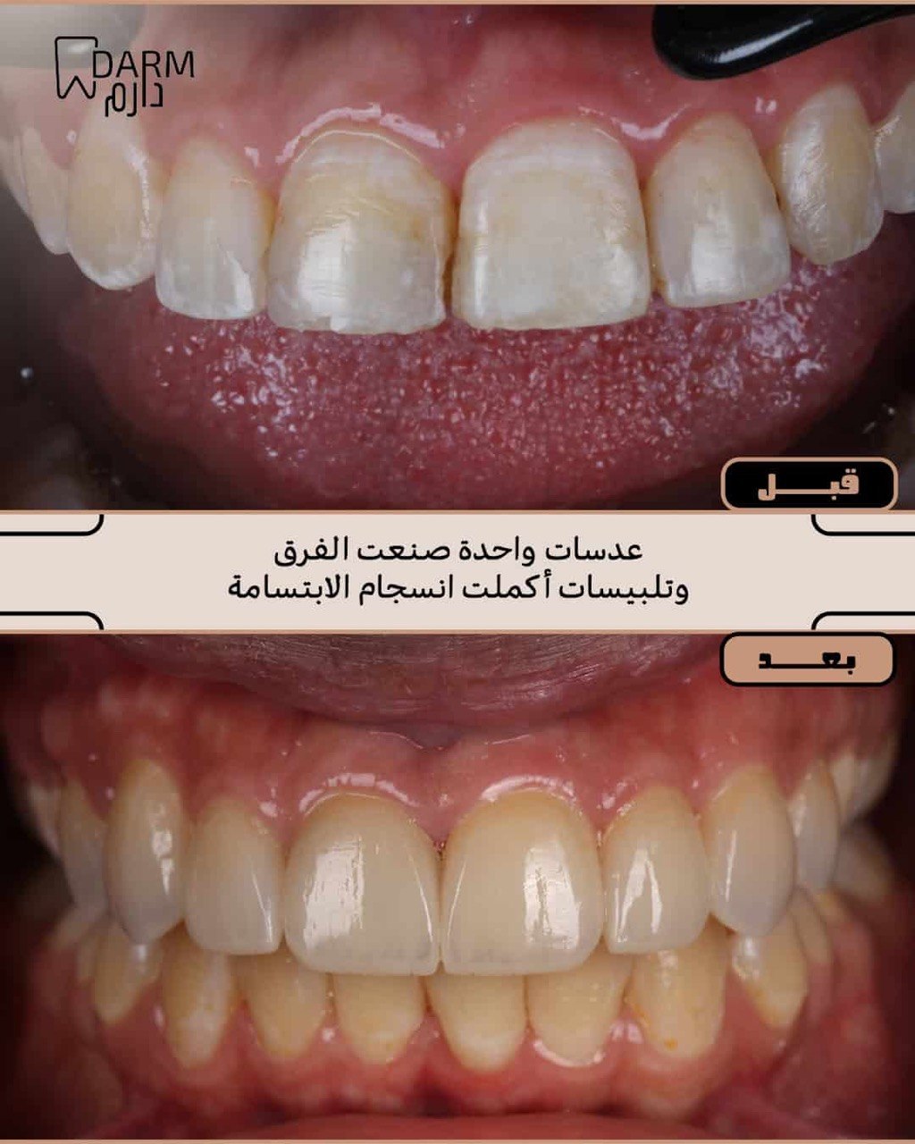 حالة 6